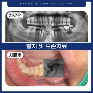 군포치과추천