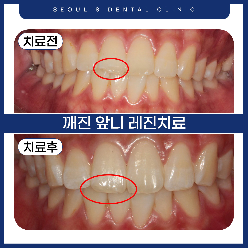 산본역치과